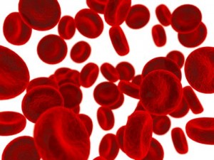 Article : Sacree anemie severe